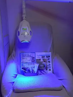 歯ホワイトニングminimo限定1回