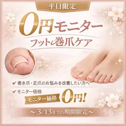 【モニター】巻爪ケア👣⸒⸒注意事項をお読みください