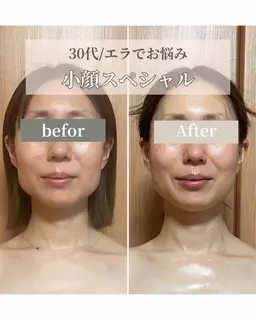 【モニター3名様募集】骨から整える小顔3回数券