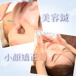 限定メニュー🌟【 美容鍼＋小顔矯正 】