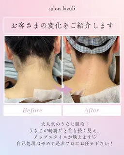 【新規女性/後ろ姿の清潔感アップ！】うなじワックス+光脱毛¥4400