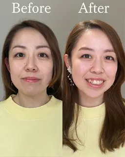 顔タイプ診断®