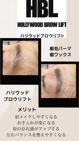 ハリウッドブロウリフト