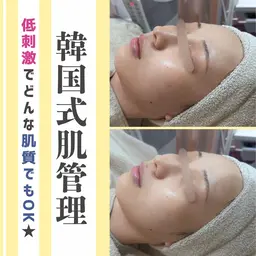 人気NO.2🤍〈韓国肌管理〉ララピール　(剥離&ダウンタイムなし) 60分5,000円