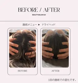 小顔リンパ × ドライヘッド ✨