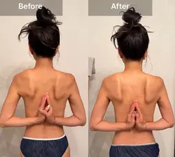 2月限定！超お得🉐！【美背中/肩甲骨出し】インディバ越え★WINBACK華奢見え!60分¥16,000→¥5,500