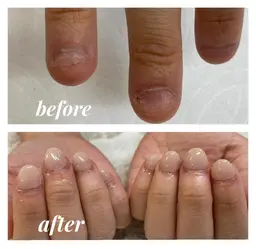 深爪矯正🌸自爪育成コース💅✨✨深爪、噛み癖、爪の矯正にオススメワンカラーorグラデーションお選び頂けます💕