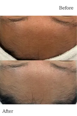 ＼口コミ書いてくださる方限定🎁／ｶｳﾝｾﾘﾝｸﾞとｴｽﾃ体験が無料🌿‬人気の為【毎月5名様限定】💖