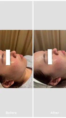 ベッドフェイシャルエステ タラソパック