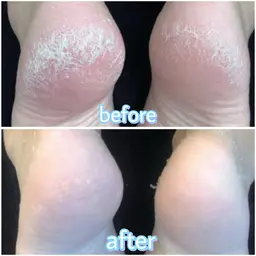 【素足美人♡】かかとピーリング👣＋脚オイルマッサージ付45分