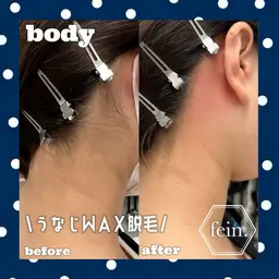 【うなじワックス脱毛】🤍ྀི角質も一緒にケアしてツルスベ肌に✨トーンアップ効果🫧