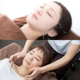 美容鍼灸＋小顔矯正【ご新規様期間限定✨】15600→3000