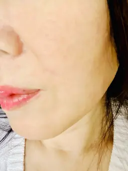 【ヒト幹細胞フェイシャル】クレンジング+ピーリング+植物性幹細胞導入+ヒト幹細胞入炭酸パック+アフターコスメ、ツヤ肌に！