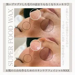 バズり中◆毛も取れる毛穴洗浄◆フェイスワックス+毛穴超音波洗浄➕韓国で大人気コラーゲンモデリングパック