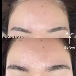 【産毛・毛穴ケア】全顔フェイスワックス※アイブロウ部分は含まれません