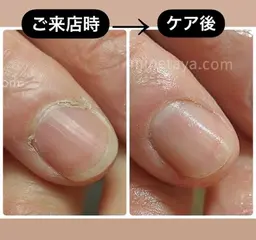 フットケアのみ‼️(甘皮処理 爪の整形) ※オフは別途料金かかります