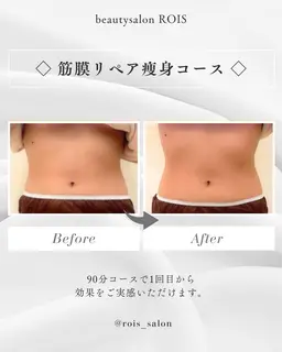 筋膜リペア痩身【フルコース】120分