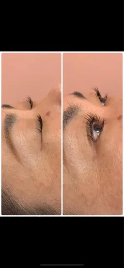 【パリジェンヌラッシュリフト】まつ毛の根元から立ち上げます。アイシャンプー&高濃度ビタミン美容液トリートメント付