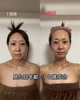 リピーター様限定❣️【速攻小顔×ヘッド】デコルテ・首・背中集中ケア✨セルキュア4t+EMS使用（大阪/梅田）