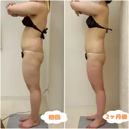 【部位別にお悩みがある方❗️】上半身or下半身×2回が今なら¥7,700✨最新キャビラジor次世代機器+ハンド技術‼️