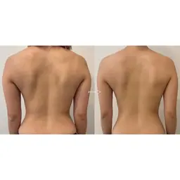 【ミニモ限定】美肌全身リンパマッサージ80分