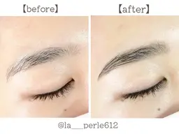 【ハリウッドブロウリフト】