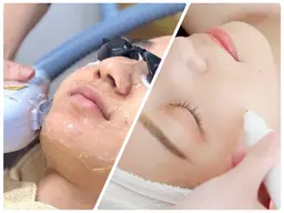 【低周波シミケア20分＋光フェイシャル】シミ/毛穴/ニキビ/くすみ/シワ/たるみ/リフトアップ/ターンオーバー