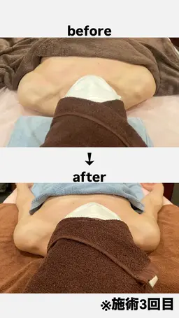 巻き肩めっちゃ酷いよ！って方限定！！癒しと効果を実感してみてください♪（デコルテ、首を施術します）