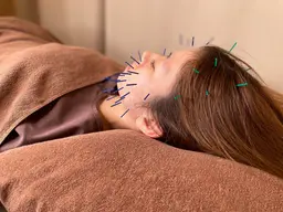 🉐【初回限定】ヒト幹細胞美容鍼