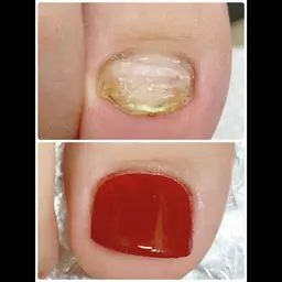 (オフなし)爪育☆フットジェルネイルご相談シンプルコース（施術時間90分）￥9,000