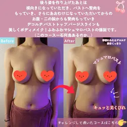 【🎄Xmas特価✨】バスト🆙&痩身🔥┃お腹、腰回り、背中、二の腕の贅肉をバストへ！形状記憶マシュマロバストメイク☆
