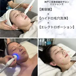人気No,2美肌と小顔が一度に叶う【美容鍼】×【ハイドラ毛穴洗浄】×【小顔矯正】×【エレクトロポレーション】約60分