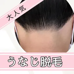 』うなじ脱毛 シェービング込み ￥3300円