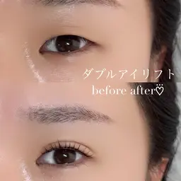 【最新美容整体 × 最新まつげパーマ】ダブルアイリフト🫧
