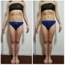 PRセル&ラジオ波60分コース