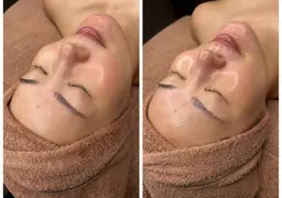 ✨✨地域最安値✨✨ミニモ特別価格🌈練習モデル🍀ララピール★肌を育てる剥離しないピーリング目から下のみの施術