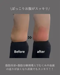 うきわ肉撃退2カップ体験コース