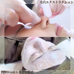 迷ったらこれ！ノーファンデ肌へ🫧【毛穴エクストラクション✖️face脱毛】感動の肌を❃ 美肌さんはやっています❤︎︎