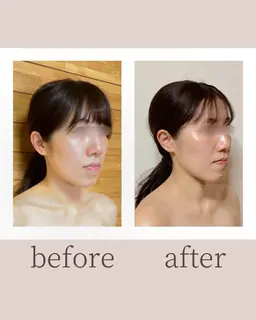 【モニター】〈くすみ・顔の重さに〉独自の血流マッサージで血流を整え、晴れやかな顔へ