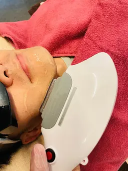 【メンズ】髭脱毛