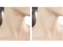 ☆最新7Dビューティー首のたるみケア、お悩み解消！仕上げ後若々しく印象へ♪