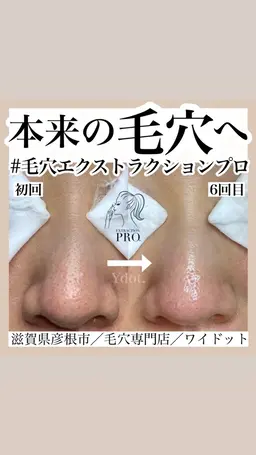 毛穴スッキリ美肌コース