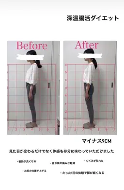 【口コミ募集】姿勢・むくみ改善｜体験価格｜期間限定