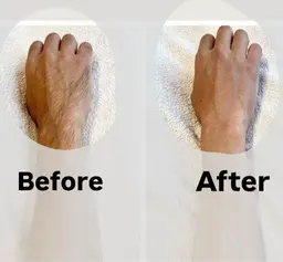 【minimo限定】選べるミニパーツ⭐︎シュガーリング脱毛【胸周りorへそ周りor手の甲＆指】