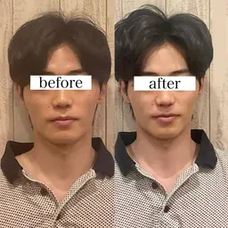 【メンズ限定💆‍♂️】立体美顔&ツルスベ肌💫小顔矯正ハイドラフェイシャルで垢抜け《毛穴洗浄/ニキビ/肌荒れ/乾燥》