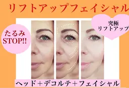 リフトアップエステ