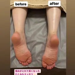 【ボディ】痩せやすい身体に変える痛くない筋膜リリース