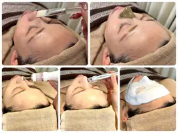 【鼻だけエステ✨】鼻だけ気になる方にオススメ💖どうしても気になる黒ずみ・開き毛穴に😍最後のパックはお顔全体引き締め✨