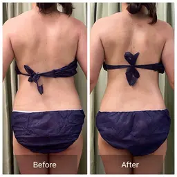 【人気No.1】筋膜×腸もみ🌱首肩こり/腰痛/便秘/くびれ/足のむくみに🌟 全身90分