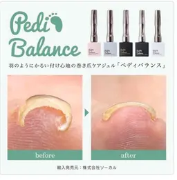 【最先端巻き爪ケア】ジェルを楽しみながら巻爪ケアできます❣️ペディバランス🐾
